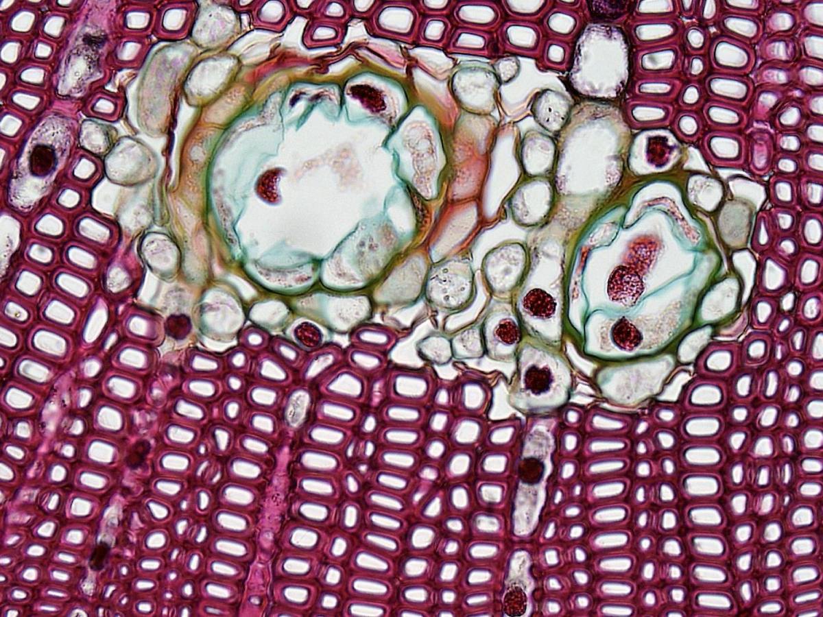Getting clearer on boundaries 